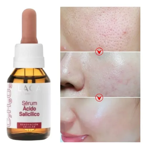 Serum Ácido Salicílico 2% Piel Grasa Reduce Poros Laca Momento De Aplicación Noche