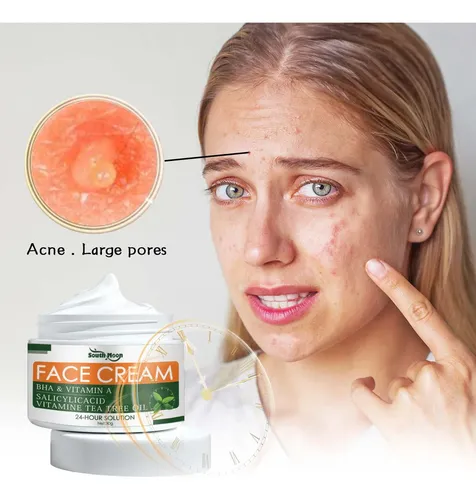 Crema Facial Suavizante South Moon, Suave, Refrescante E Hid Acneica Día/noche
