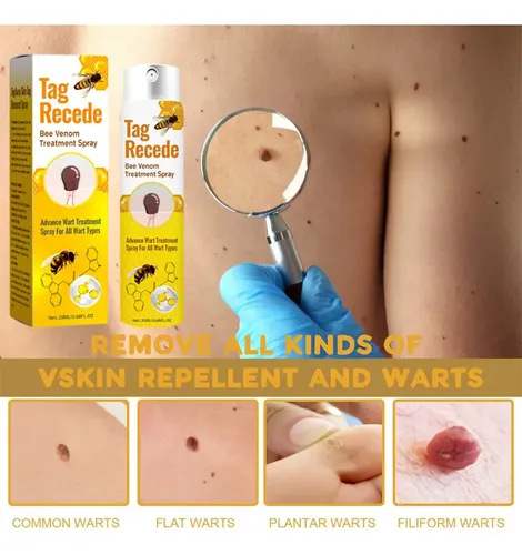 Gel De Crema Removedor De Verrugas Para Rostro Y Cuerpo, 3
