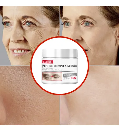 Crema Antiarrugas, Blanqueador De Arrugas Y Antienvejecimien