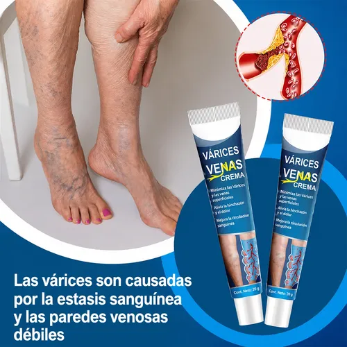 Crema Varices Estrías Descanso Piernas Post Jornada Larga