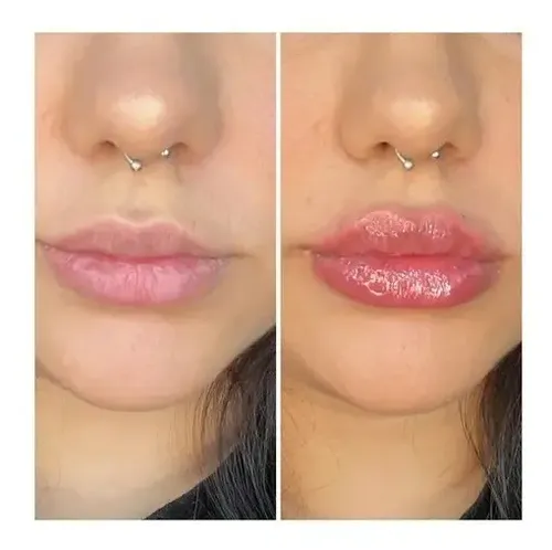 Labial Gloss Voluminizador, Labios Colageno, Karite