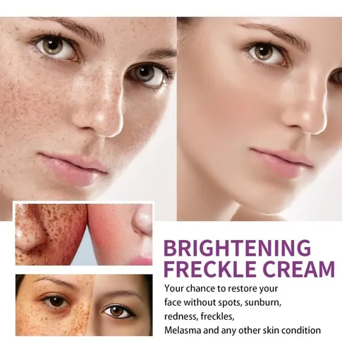 3*crema Urea Antimancha, Eliminación Reducir Manchas Oscuras