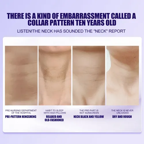 Crema Avanzada Para El Cuello Que Decolora Y Deja Líneas De