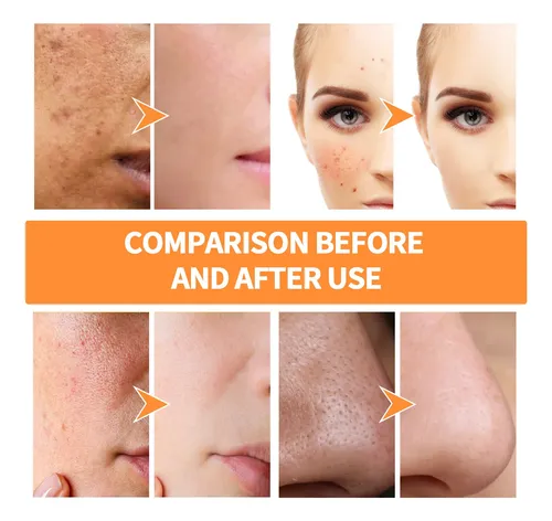 Mascarilla Clay Stick Q+v 40g