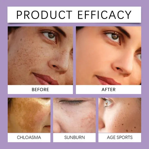 Crema Despigmentante Y Aclarante Facial 30g Para Piel