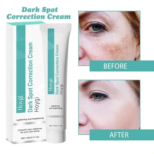 3pcs Crema Correctora De Manchas Niacinamida*