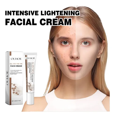 Crema Blanqueadora Hidratante For Aclarar Las Manchas