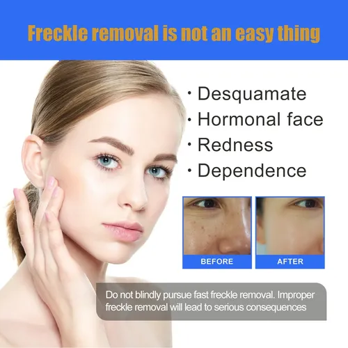 Crema Iluminadora Única Para Manchas Faciales, 50 G, Melasma
