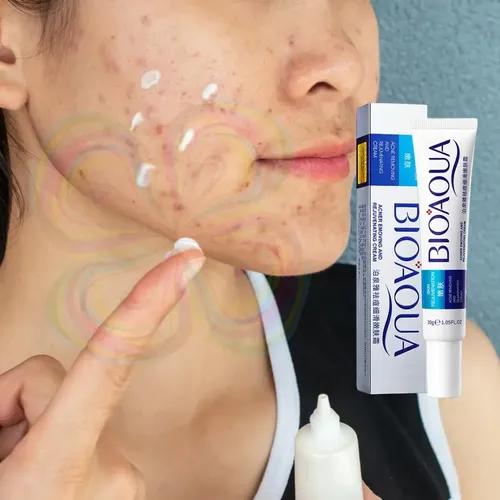 Paquete 3 Cremas Bioaqua Puntos Negros Anti Acne