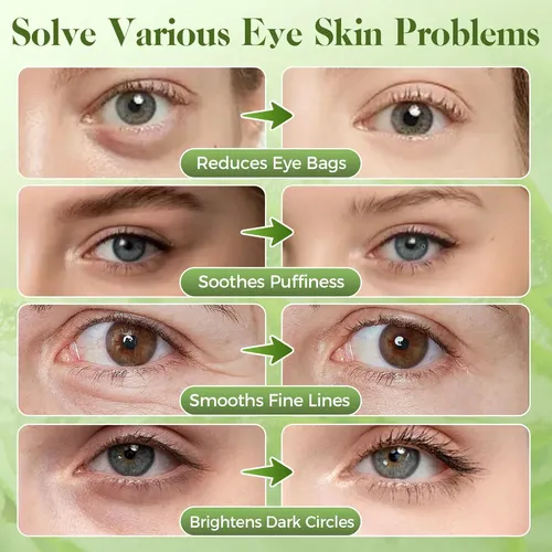 Nexkayee Parches Hidrogel Contorno De Ojos Aloe