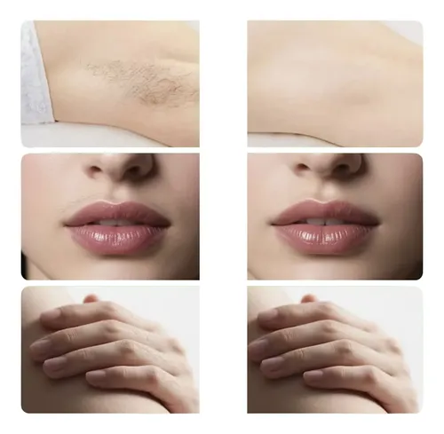 Bandas Cera Facial 30 Tiras Doble Cara Piel Sensible Mujer
