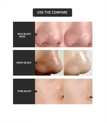 Aj 1×máscara Desgarradora Miel, Máscara Exfoliante, Piel