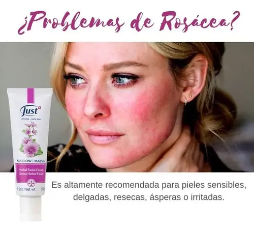 Crema Herbal Facial De Malva Just Tipo De Piel Rosacea