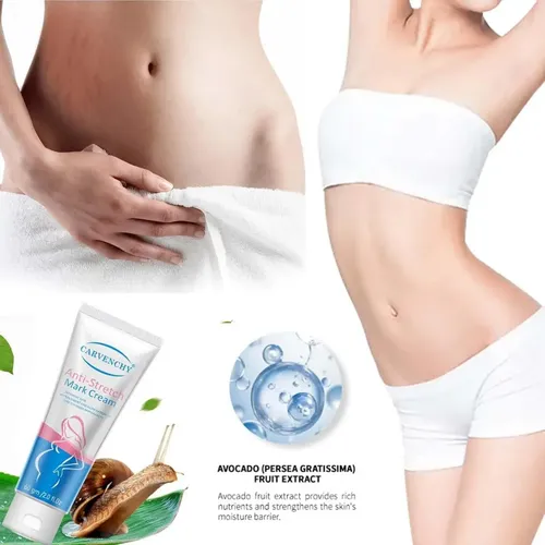 Jh Ah Crema De Estrías For Mujer, Crema Hidratante Corporal