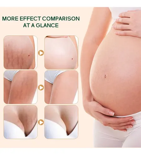 Aceite Corporal Hidratante Para Piel Normal, Cuidado Corpora Essential Oil