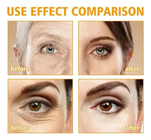 Crema Reafirmante Para Ojos, Elimina Bolsas Y Ojeras.