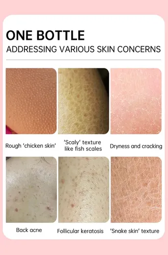 Crema Reparadora Urea 25% Para Piel Seca Y Áspera Joypretty Fragancia Neutra