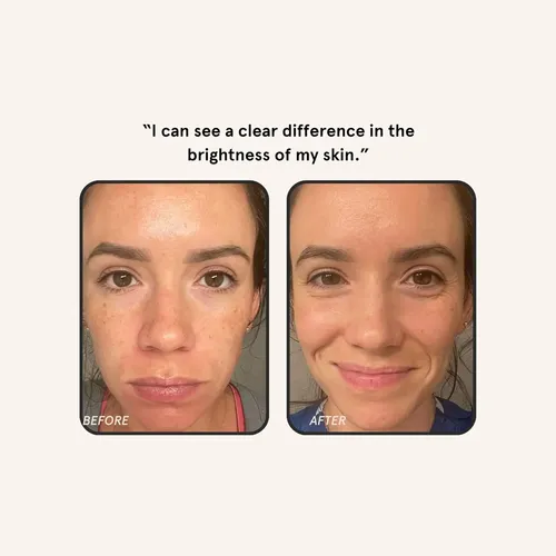 Sérum Bareface Liquid Gold Con 15% De Vitamina C, 1 Onza Líq