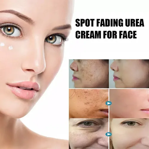Crema De Urea Para Atenuar Manchas,crema De Urea Para Rostro