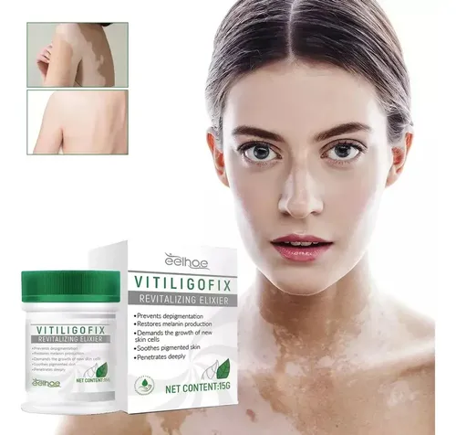 Crema Reparadora De Manchas De Vitíligo Yj