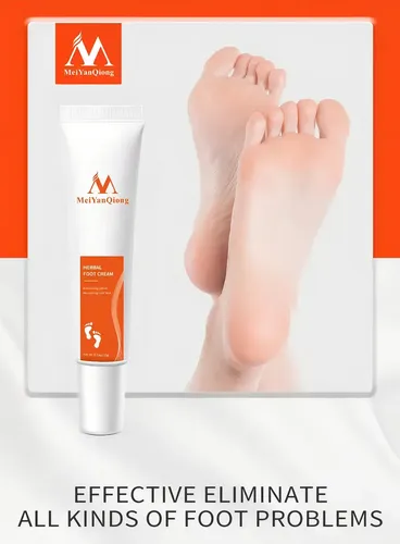 Crema Tratamiento De Pie De Atleta Hongos Y Olor En Pies Herbal