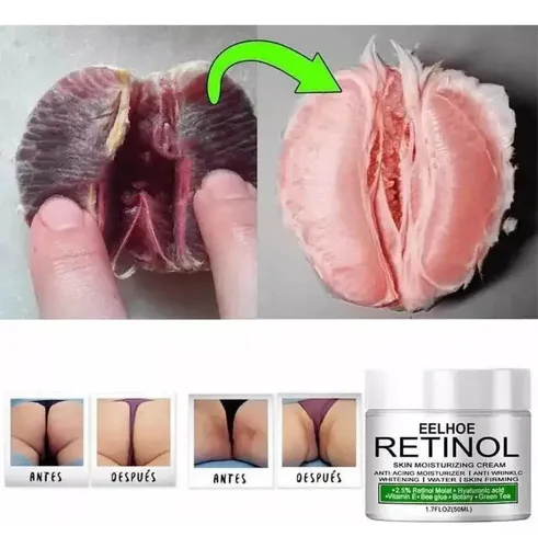 Crema Aclaradora Íntima Y Axilar Con Retinol