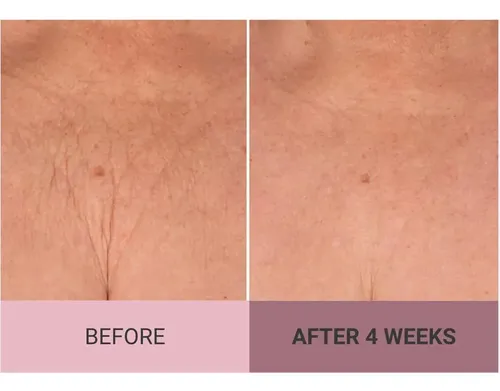 Consult Beaute Champagne Lift Crema Corporal 8 Oz Rosa