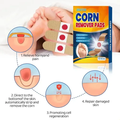 Cuidado De Los Pies De Verruga Espinosa Con Crema De Ojos De
