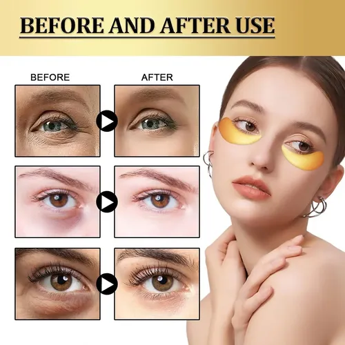 Parche Ocular De Ácido Hialurónico (elimina Ojeras, Bolsas E