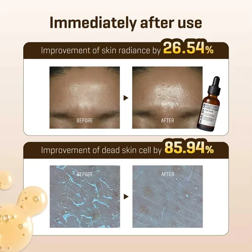 Sérum Resplandeciente Con Vitamina C Pura Some By Mi Galacto
