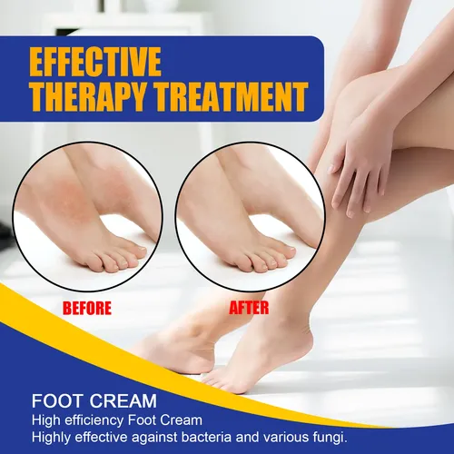 La Crema Para El Cuidado De Los Pies South Moon Nutre Y Prot