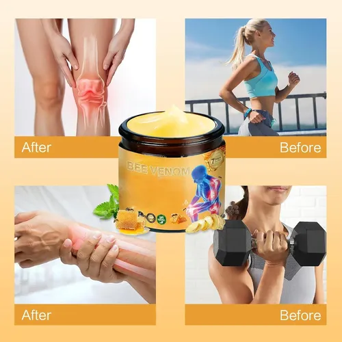 Crema De Veneno De Abeja Para Articulaciones Zxztsm 1 Unidad