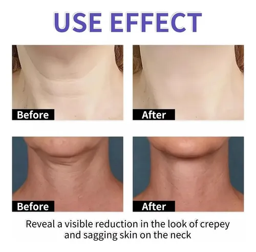 Hx 2 Piezas Crema Lifting Reafirmante De Cuello, Crema