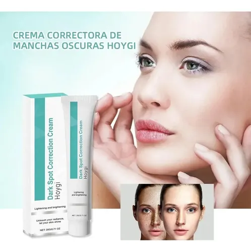 Ae La Crema Correctora De Manchas Aclara Las Manchas Oscuras