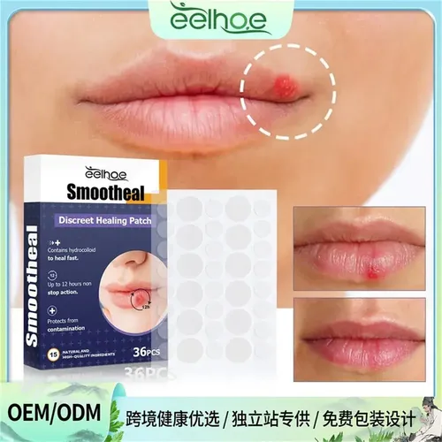 Tn 3 Parches Útiles For Aliviar El Herpes Labial Y Curar