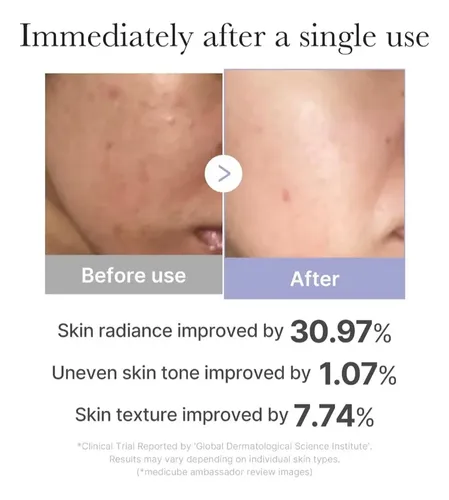 Mini Booster Pro Blanco De Medicube – Maquina Cuidado Facial Todo Tipo De Piel Día/noche