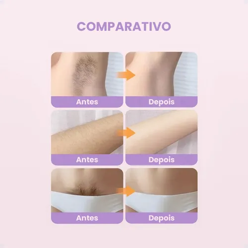 Depiladora Eléctrica Mujer 2 En 1 Lila Body Hair 5v //