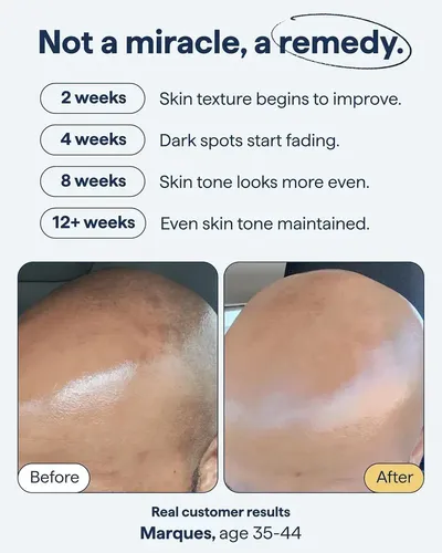 Loción Facial Hidratante For El Cuidado De La Piel, Cuidado
