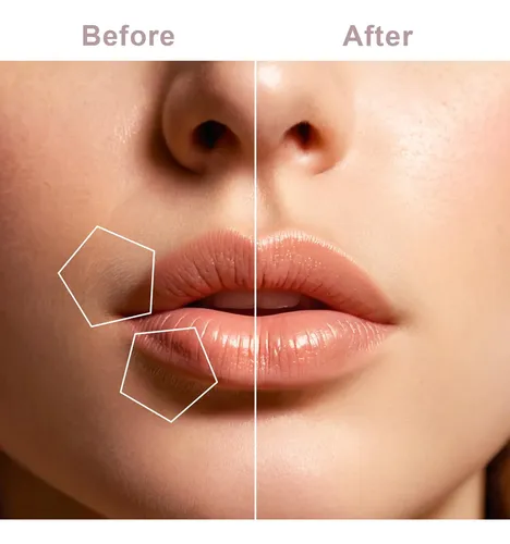 Depiladora Facial Para Mujeres Tuokiy, Afeitadora Facial Rec