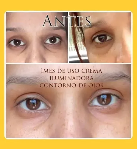 Farmasi Lumi Radiance Crema Contorno Ojos Iluminadora Hipoalergénica 20ml
