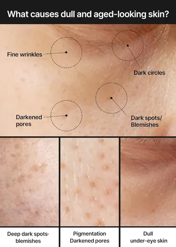 Celimax Crema Iluminadora Manchas Oscuras Aclarante Todo