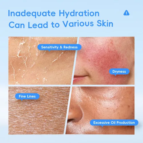M* Tónico Facial Laikou Hyaluronic & Collagen – *xl