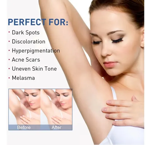 Crema Aclarante Zonas Íntimas Exfoliante 30 Ml