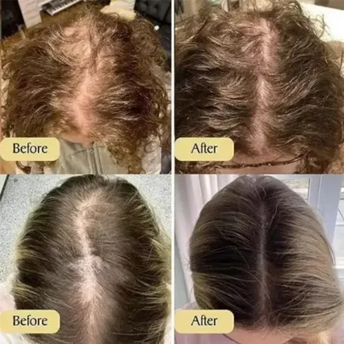 D 2pcs Aceite Esencial Para Cuidado Del Cabello Veganic D
