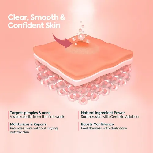Crema Acne Facial 40 Ml Her Kozmetik Faceupskin