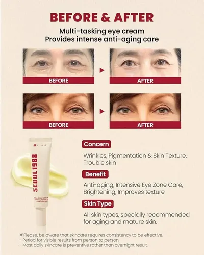 Crema De Ojos Ksecret: Liposoma Retiniano Al 4% +frijol Ferm