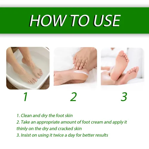 La Crema Para El Cuidado De Los Pies Eelhoe Hidrata Y Cuida