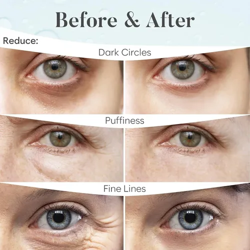 Aurae Parche Eye Patches Azul 30 Pares Hyaluronic