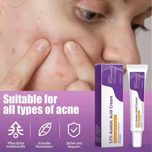Crema Calmante Anti-acné: Ideal For Piel Sensible ^.^